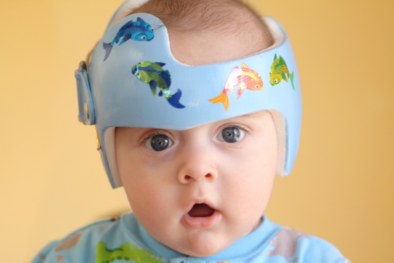 baby wearing a helmet