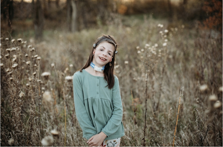 Mandibulofacial Dysostosis with Microcephaly (MFDM)