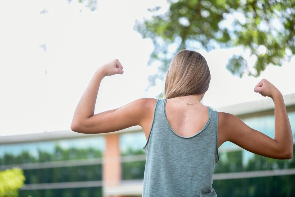 Young woman flexing her arm muscles outdoors
