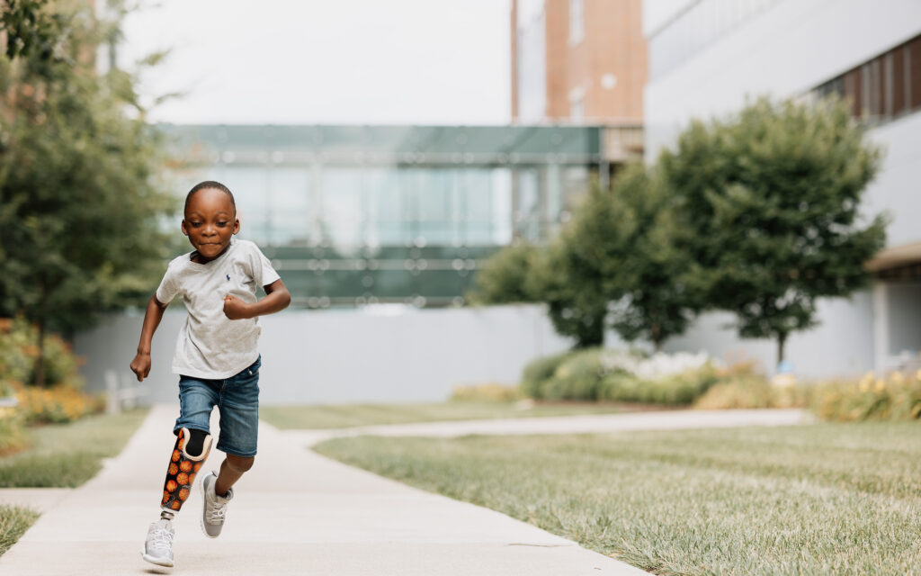 Young boy with a prosthetic leg running outdoors near a children’s hospital, showcasing progress after physical medicine and rehabilitation treatment.
