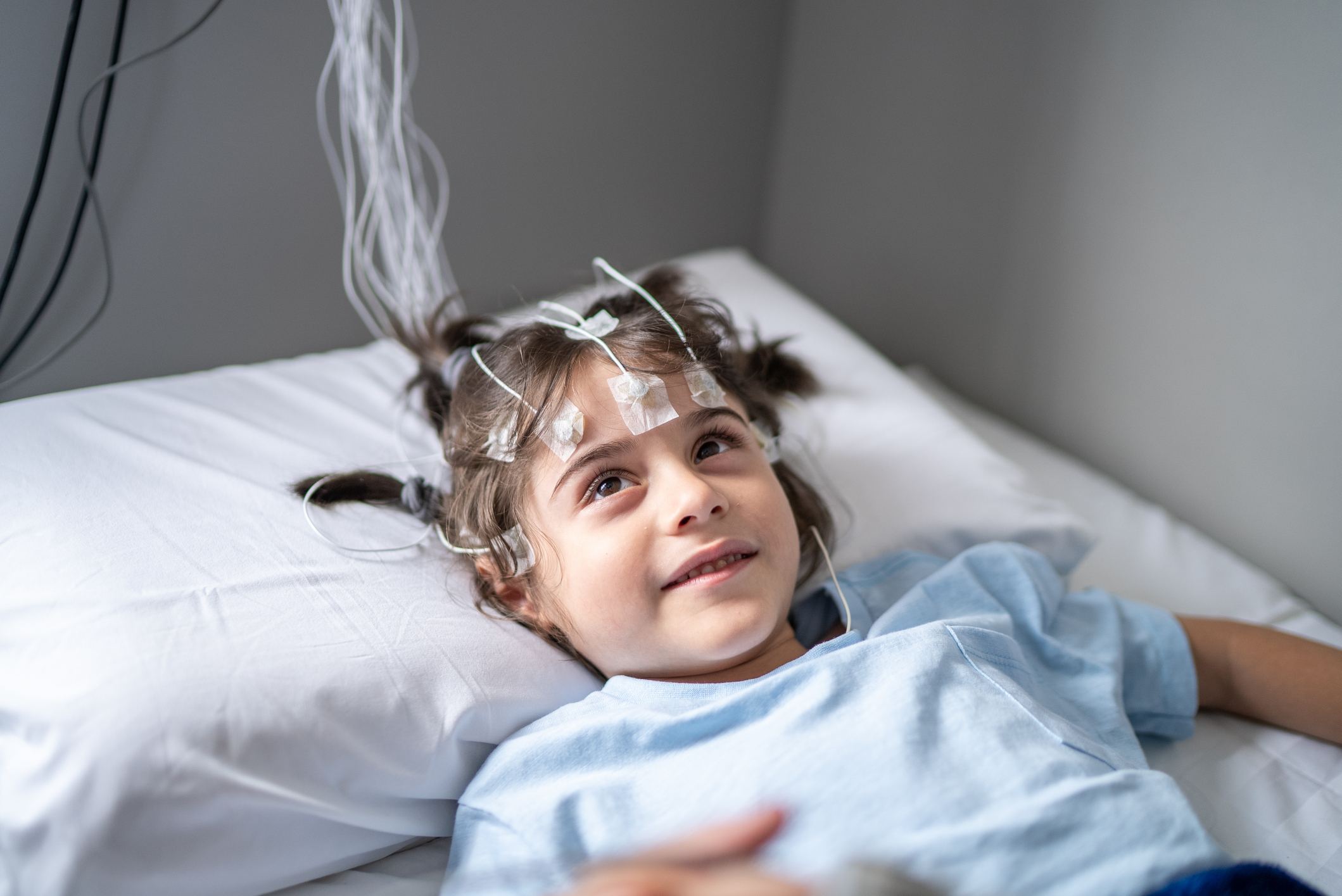 A young girl is lying on a hospital bed with multiple electrodes and wires attached to her head and face for a sleep study related to obstructive apnea.