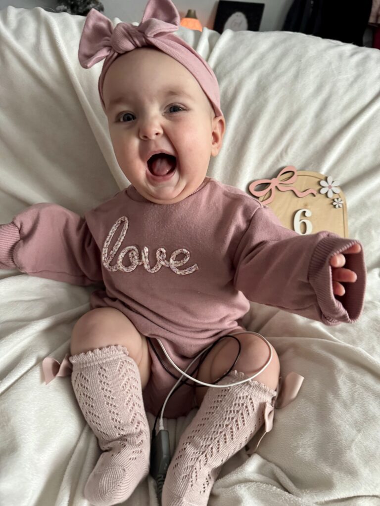 happy baby poses for picture with medical heart monitor attached
