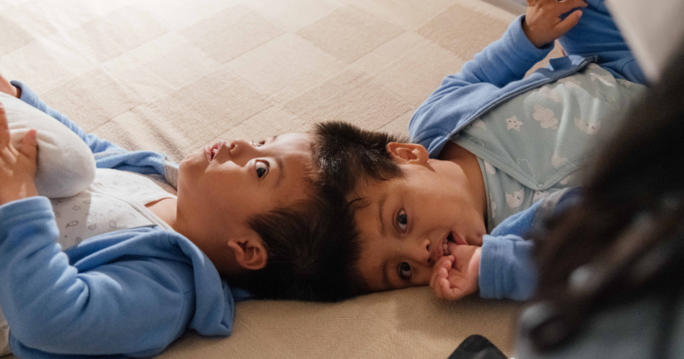 Pedro and Augusto, conjoined twins, were separated at Dayton Children's in 2022